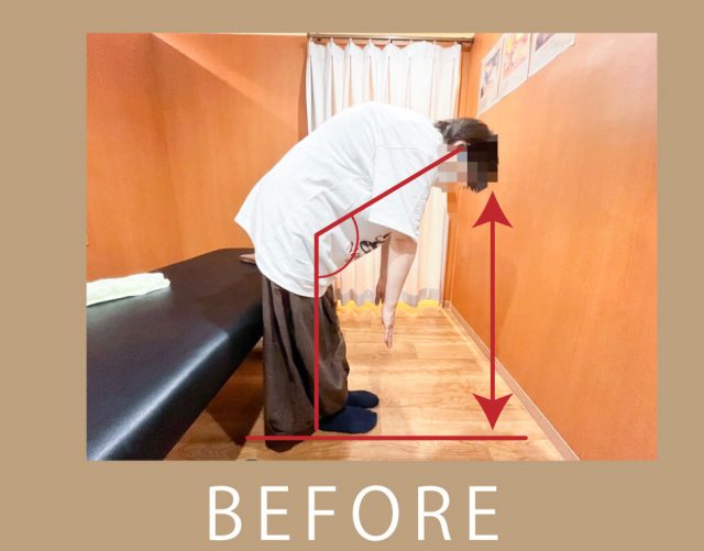 before画像