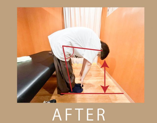 after画像