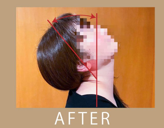 after画像