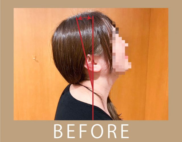 before画像