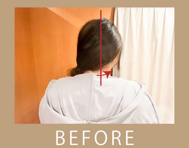 before画像